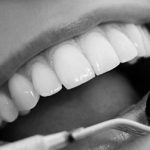 Periodoncia